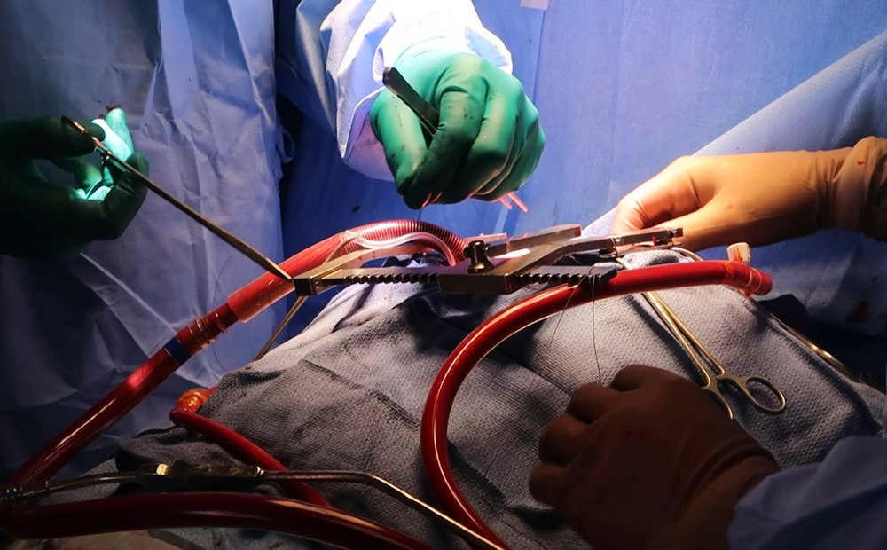 На запорожском направлении военные врачи провели операцию на открытом сердце / События на ТВЦ