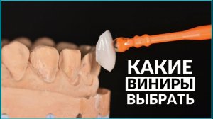 Как выбрать виниры и какие виниры лучше? Керамические виниры. InSmile