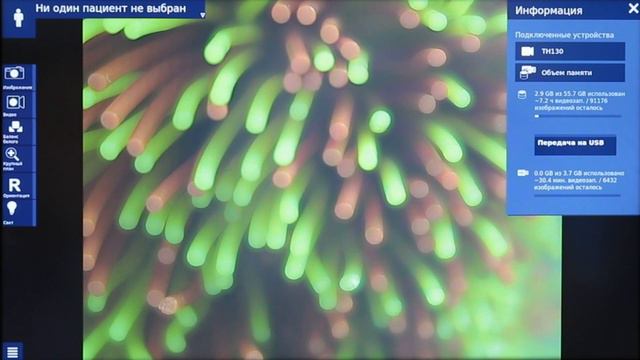 Инструкция по эндоскопическому блоку TELE PACK+. Первое включение: настройки. смотреть онлайн