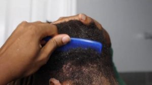 Dandruff Scratching ASMR | Removing Big Flakes From My Locs #dandruffremovalasmr #dreadlocksdandruf