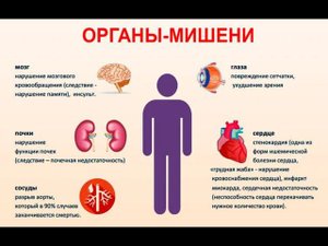 LR : гипертония - причины, программы для нормализации давления,отзывы.