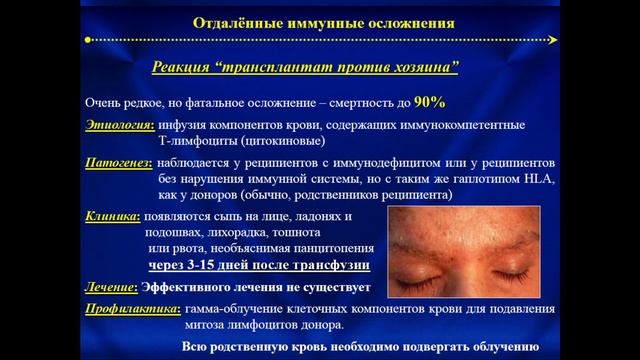 Основы трансфузиологии 3 смотреть онлайн