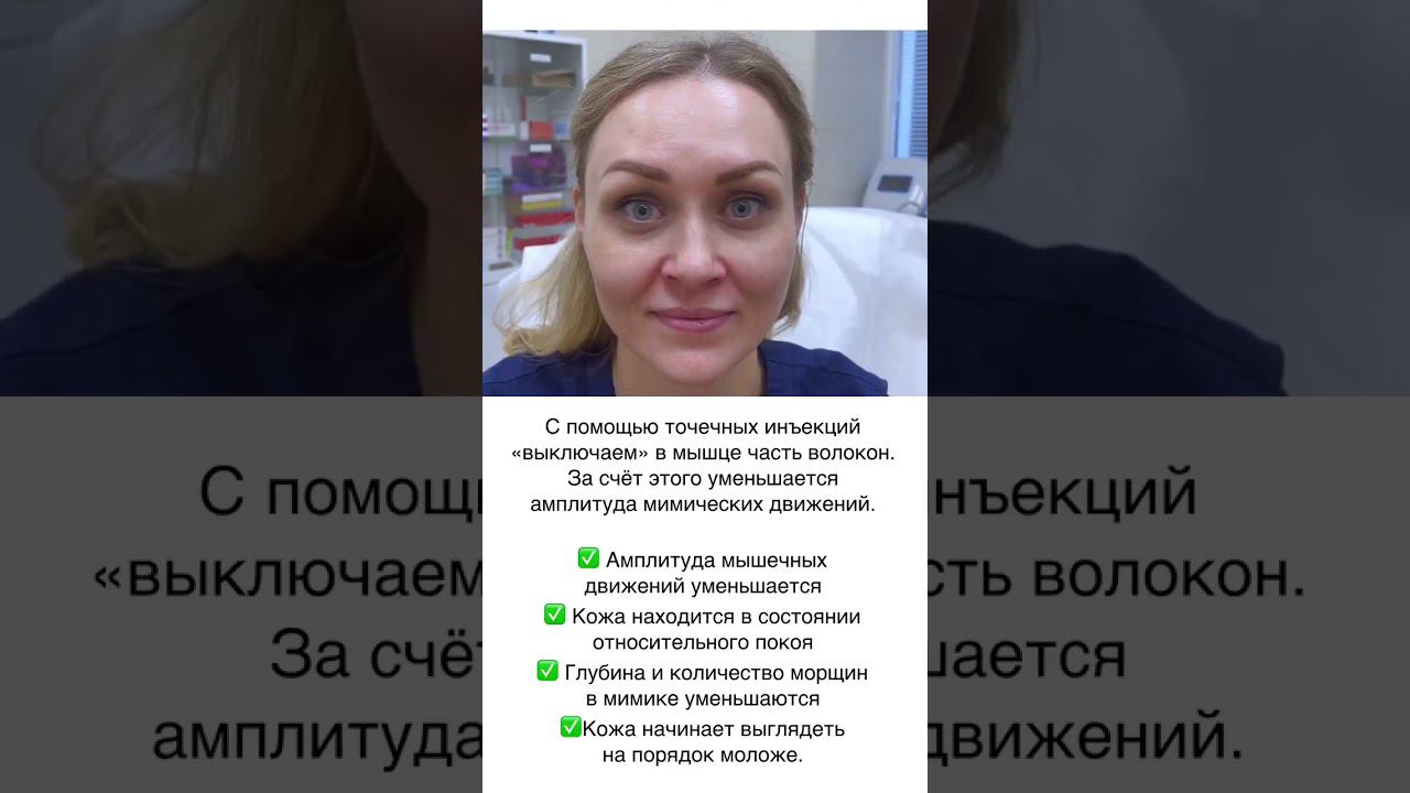 #БОТОКС - атрофируются ли мышцы? смотреть онлайн