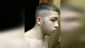 Миноксидил для бороды. Результаты. 6 месяцев. ПОСЛЕДСТВИЯ