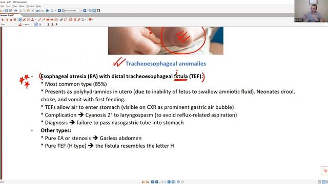 TA7 USMLE STEP 1: GIT 1 (TRIAL LECTURE) смотреть онлайн