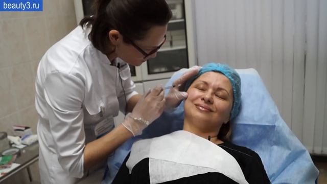 Инъекции диспорт в области межбровья, лба, вокруг глаз, верхней губы