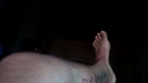 Съемный полимерный гипс Перелом лодыжки