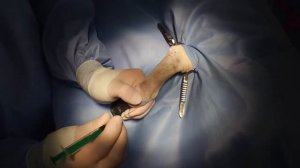 3мх - пункция запястного сустава