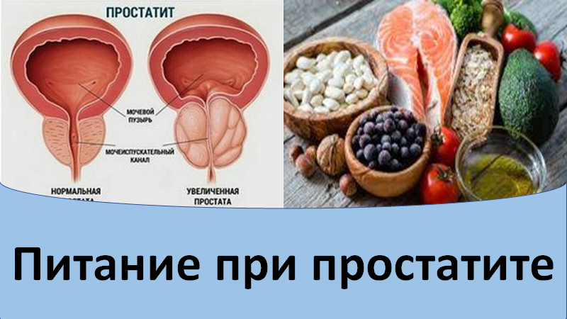 Питание при простатите и аденоме простаты. Питание при простатите. Питание при простатите. Продукты при простатите. Питание при простатите у мужчин.