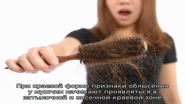 Облысение у мужчин. Как его предотвратить и что делать при облысении?