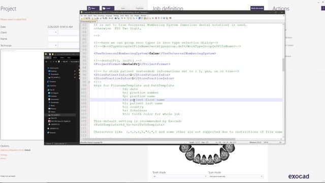 Changing exocad's naming convention and file saving location смотреть онлайн