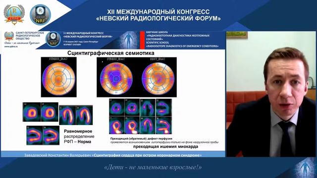 НАУЧНАЯ ШКОЛА «Радиоизотопная диагностика неотложных состояний» смотреть онлайн