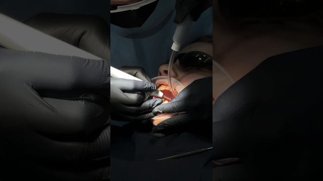 Акция! Для тех кто проводит гигиену полости рта каждые 6 месяцев! mdc-center.ru смотреть онлайн