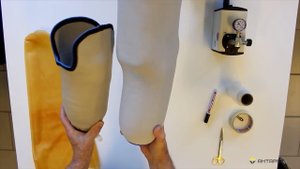 Экспресс изготовление постоянной гильзы на пациенте