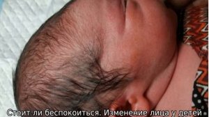 Почему у новорожденного ребенка большой, выпуклый лоб