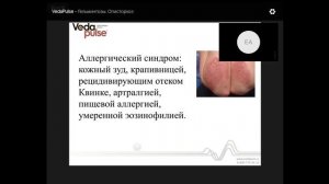 Гельминтозы. Описторхоз