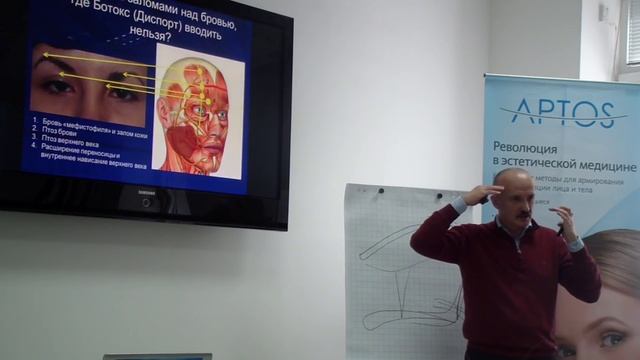 Внутримышечное применение «Диспорта» может вызвать птоз брови. estet-portal.com смотреть онлайн