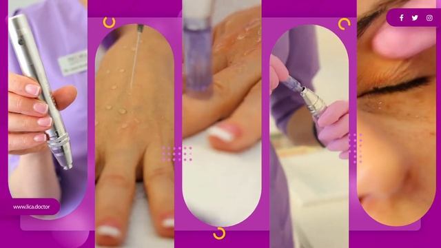 Pressensa Virtual mesotherapy Microneedling COURSE