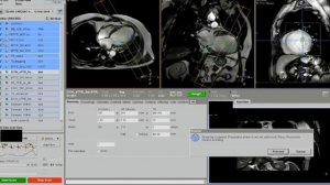 6. Live Scanning of CMR Dr  Pudhiavan