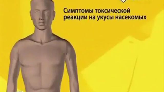 Укусы пчел, ос, муравьев смотреть онлайн