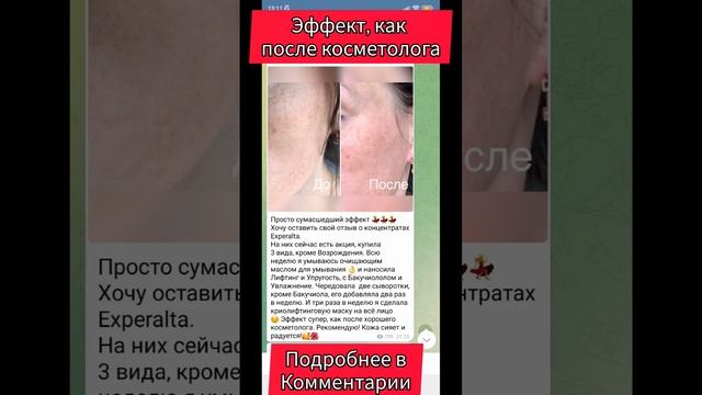 эффект, как после косметолога #уходзакожей #морщины #синяки #мешкиподглазами