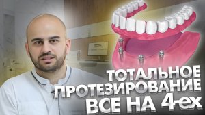 В чем суть тотального протезирования "все на четырех имплантатах" (all-on-fore)?