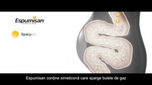 Espumisan® capsule R
