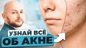 Что такое АКНЕ? Узнай самое важное об акне за 10 минут