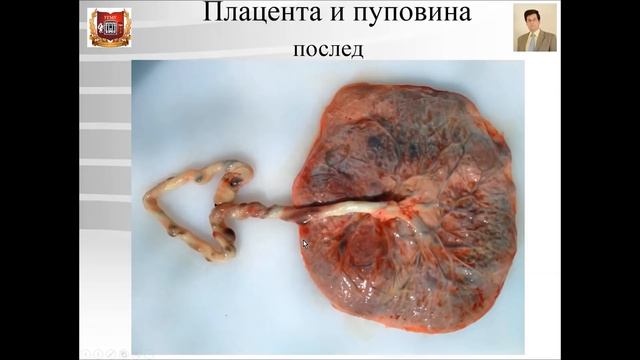 Лекция № 29. Эмбриональное развитие человека - 2.