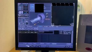 Укладка для КТ ОГК компьютерной томографии органов грудной клетки