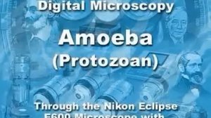 Амёба (простейший микроорганизм)