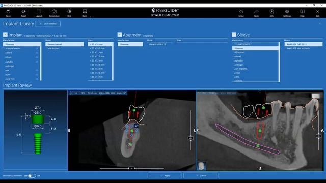 RealGUIDE 5.0 COMPLETE WORKFLOW (ENG)
