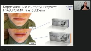 Работа с плотными филлерами дифференциальный подход в выборе показаний средней и нижней трети лица