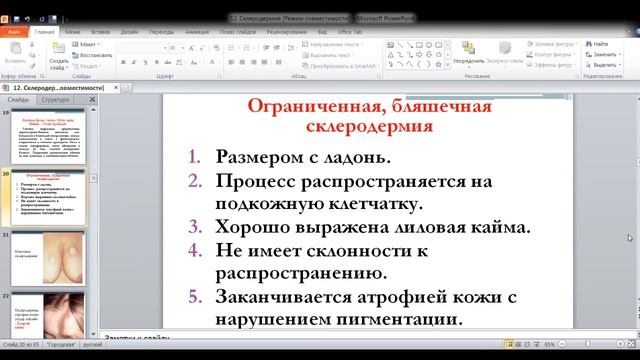 Склеродермия современные аспекты этиопатогенеза, клиники, диагностики и лечения. смотреть онлайн