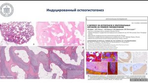О регенерации костной ткани и генетике в гистологии