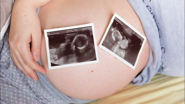 ПРИЗНАКИ БЕРЕМЕННОСТИ ДВОЙНЕЙ | На каком сроке можно определить наличие двойни смотреть онлайн