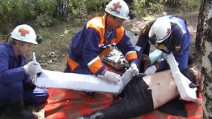 Закрытый перелом бедра