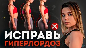 Гиперлордоз - ДИАГНОЗ? Что делать? Подробный план от спортивного врача!