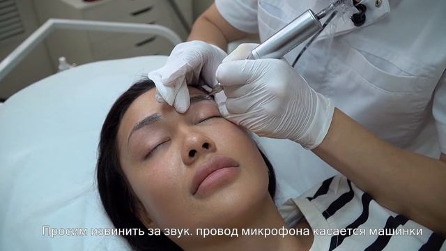 Удаление перманентного макияжа/татуажа лазером и ремувером