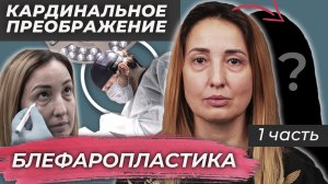 Кардинальное преображение - Блефаропластика. 1 часть.