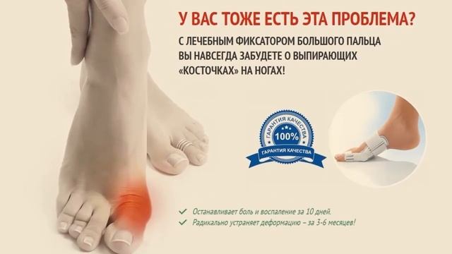 Купить Вальгусный Корректор Для Косточки Большого Пальца смотреть онлайн