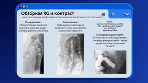 Язвенный колит и Болезнь Крона | Что нужно знать хирургу | Классификация | Диагностика | Лечение