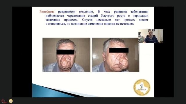 Заседание Московского областного научно-практического общества оториноларингологов