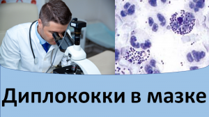 Диплококки в мазке.