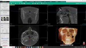 Поворот объема в программе Ez3D i