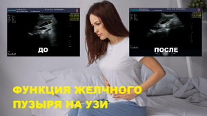 Как определить ФУНКЦИЮ желчного пузыря на УЗИ?