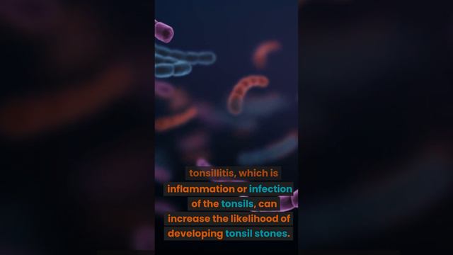 What Causes Tonsil Stones Pt 3