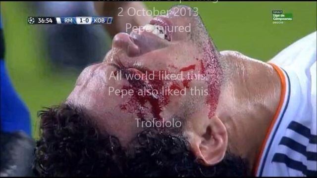 Real Madrid Copenhagen Pepe Injured смотреть онлайн