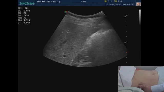 Методика проведения УЗИ печени смотреть онлайн