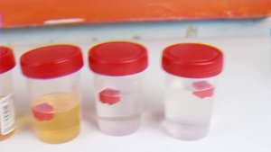 ЭТО ВЕЩЕСТВО  УНИЧТОЖАЕТ ЛЕГО...